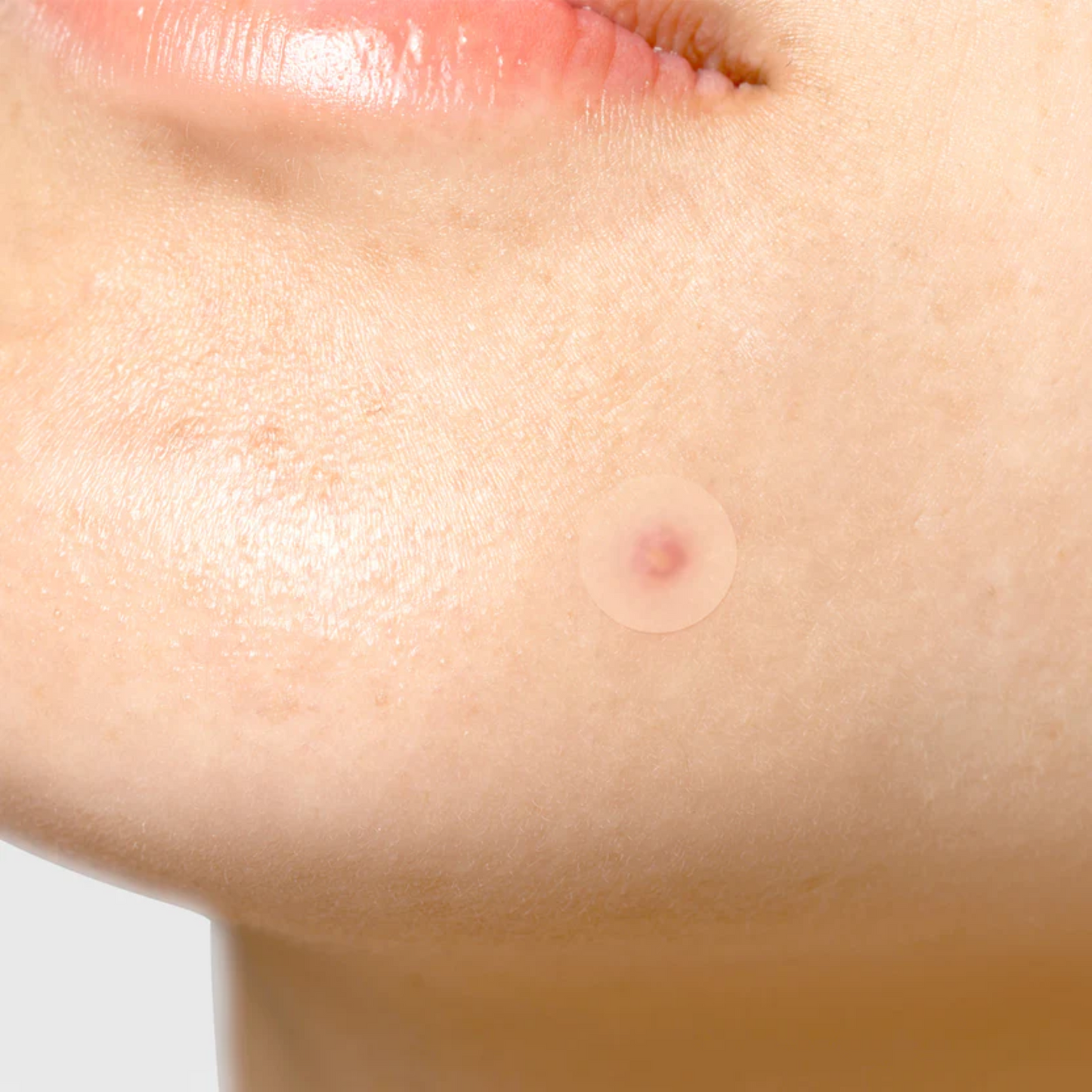 TIA'M Surprise B Patch 24 Patches